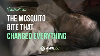 video thumbnail for The Mosquito Bite That Changed Everything