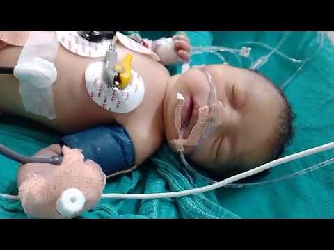 NEONATE In Miracradle Nicu Youtubeshorts