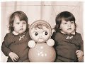 ВЫ НЕ ПОВЕРИТЕ! Как сложилась жизнь первых сиамских близнецов, рассоединенных в СССР