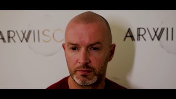 SCALP MICROPIGMENTATION / Fully Healed Result / SMP