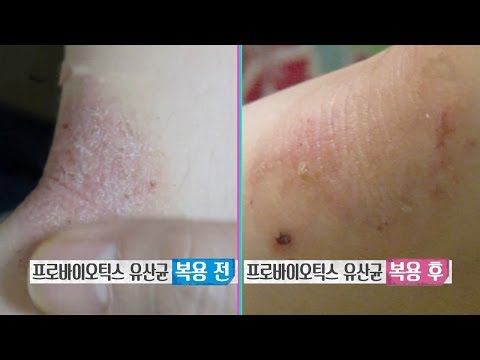 유산균, 많이 먹어야 좋다? 올바른 복용법 @좋은아침 4832회 20160415