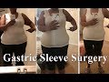 Weight Loss Over 50! | Gastric Sleeve Surgery | EXERCISE - VSG!
