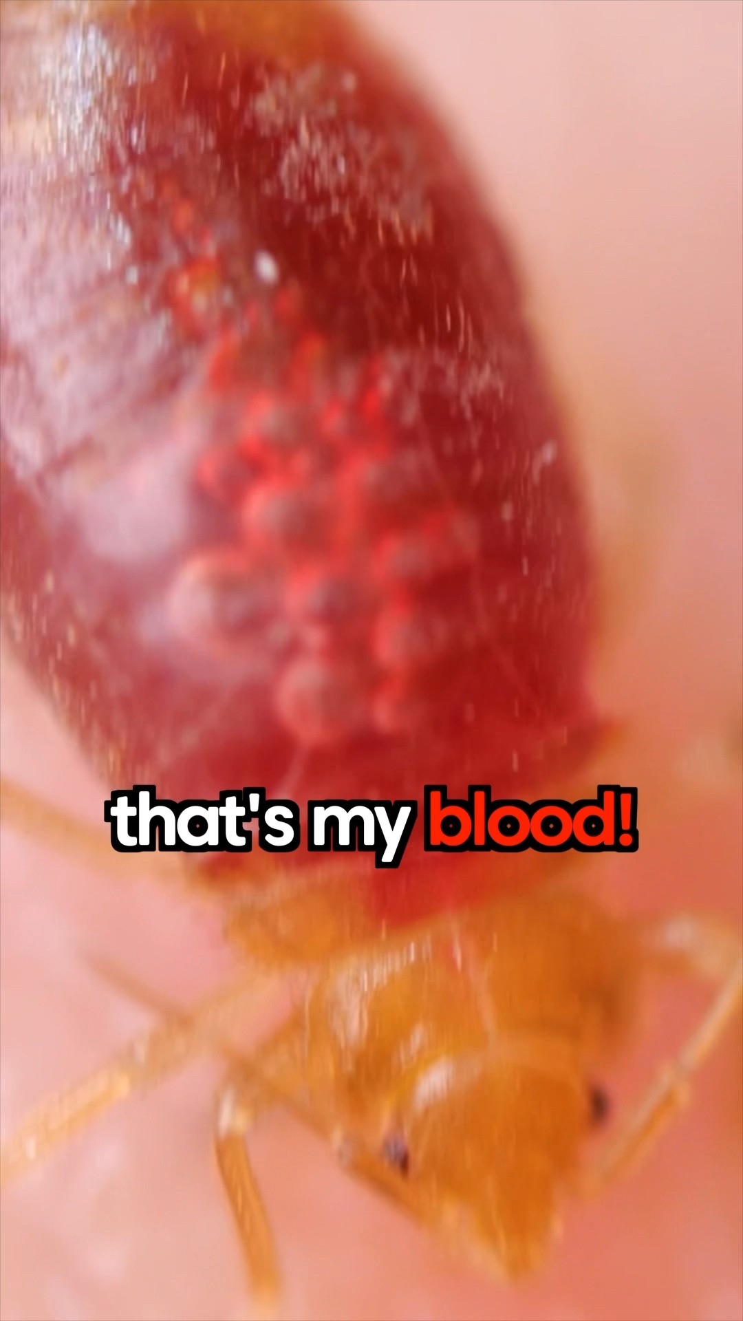 I Let A Bed Bug Eat Me