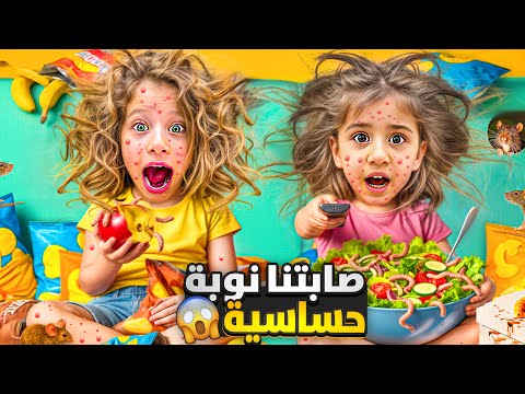 صفا ولولو صابتون حساسية وطلع على وجوهن حبوب وريحتون صارت بشعة