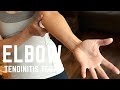 Climbers Do You Have Elbow Tendinitis? Learn These Quick Tests and Keys to Treatment