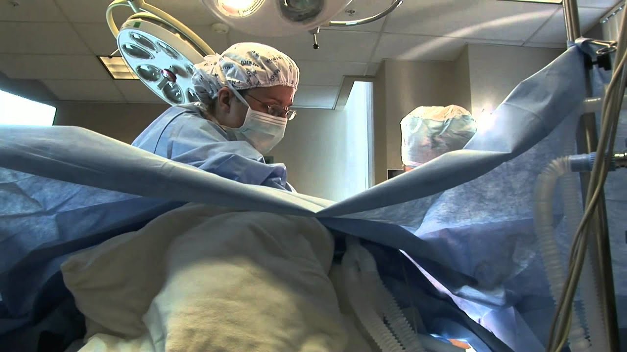 Body Lift After Weight Loss Tummy Tuck, Arm Lift, Butt Lift YouTube