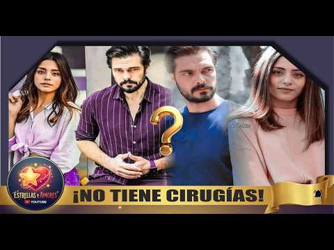 Video S?la Türko?lu responde a las acusaciones sobre cirugía estética a través de Halil ?brahim...