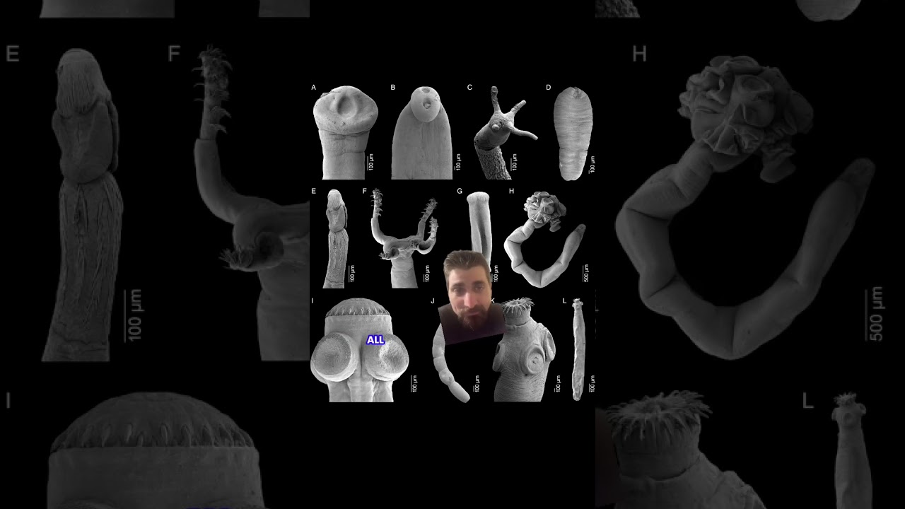 Tapeworms in crocodiles? 