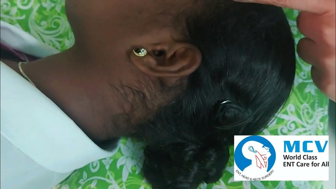 How to use ear drops?Dr.Aishwarya Anand tragalpump 