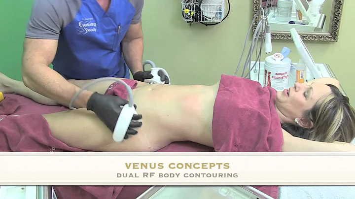 Venus Freeze body contouring by Dr. Goodnight