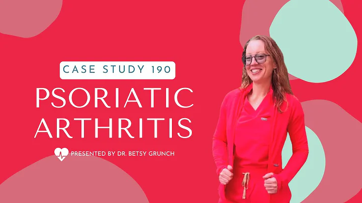Case Study 190 - Psoriatic Arthritis