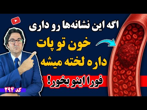 اگه پاهات اینطوریه خونت داره لخته میشه فورا اینو بخور