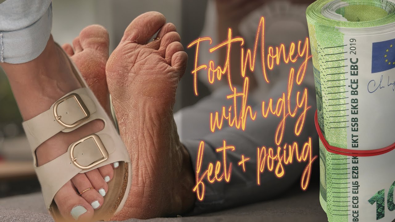 Foot Money with Ugly Feet + Posing