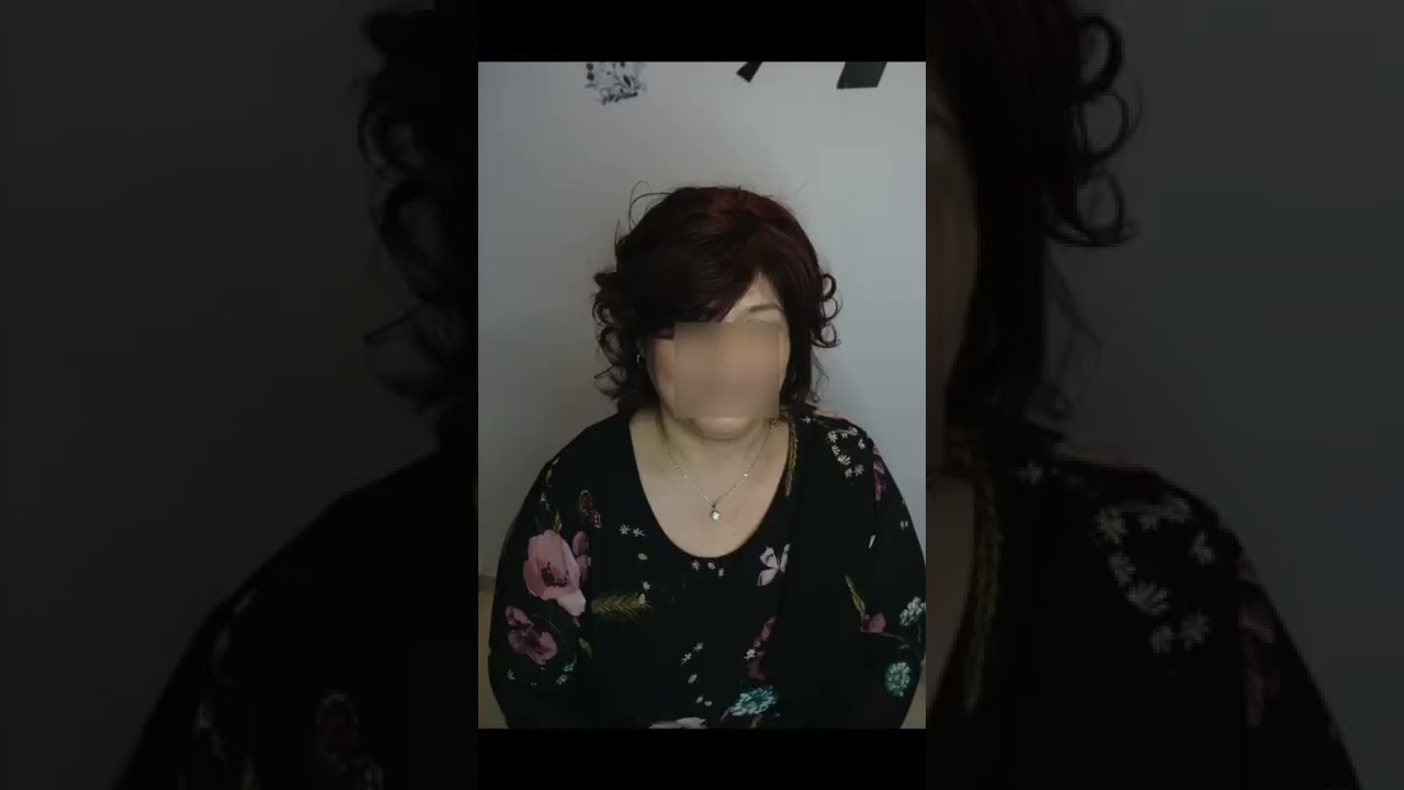 Come avviene l'infoltimento capelli - Softline Parrucchieri