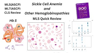 Sickle Cell Anemia and Other Hemoglobinopathies