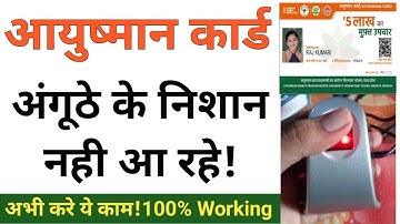Ayushman Card Finger nahi aa rahe kya kare।  Ayushman card anguthe nahi aa raha hai kya kare ।