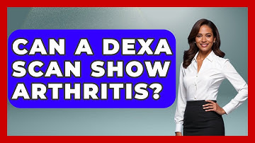 Can A DEXA Scan Show Arthritis? - Orthopedic Support Network