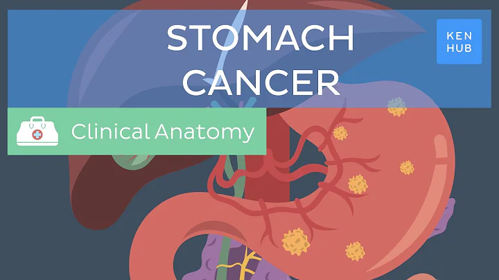 Stomach cancer: Definition, causes, symptoms and treatment | Kenhub - DayDayNews