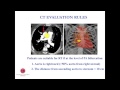 [Keynote Lecture] Minimally invasive aortic valve surgery: state of the art and future directions