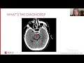 Subspecialty Discussion: Vascular Neurology - American Academy of Neurology