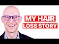 My alopecia areata journey  dr gary linkov
