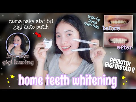 Video: Cara Menggunakan Whitening Pen: 8 Langkah (dengan Gambar)