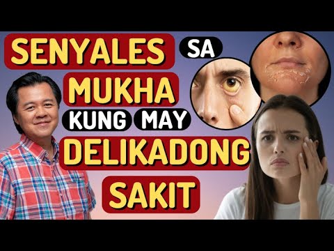 Senyales sa Mukha Kung May Delikadong Sakit   By Doc Willie Ong Internist and Cardiologist