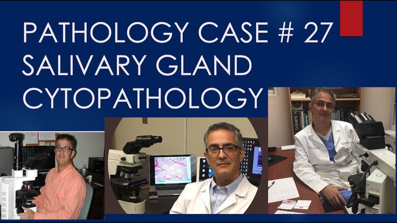 Pathology case 27 - YouTube
