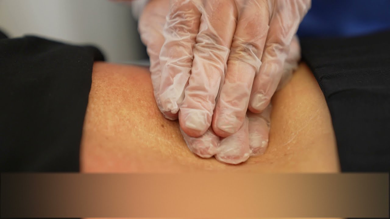 How Physical Therapists Use AcuPlus to Control Pain