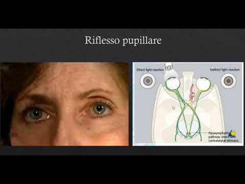 Video: Risposta Pupillare - Glossario Dei Termini Medici