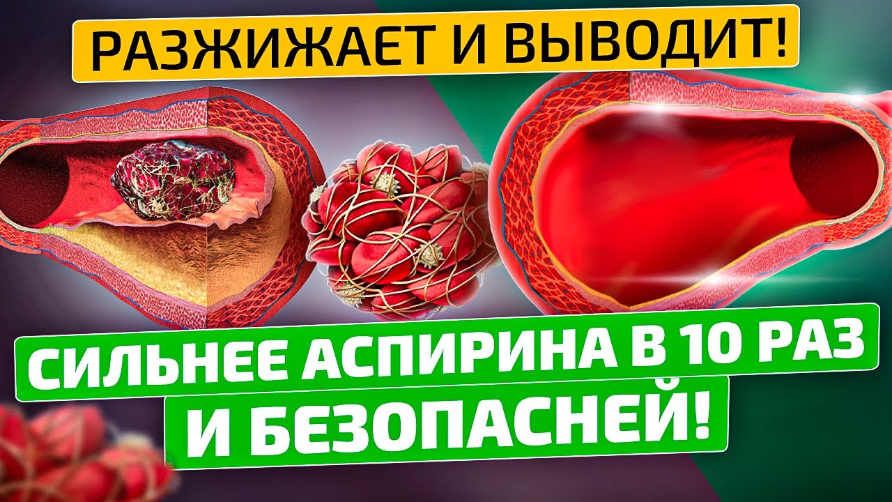 Ленивый способ НАВСЕГДА вывести тромбы, почистить кровь и избавиться от ...