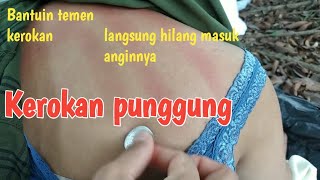 Download Lagu kerokan,kerokan wanita masuk angin #laislais MP3 Download Lagu kerokan,kerokan wanita masuk angin #laislais MP3