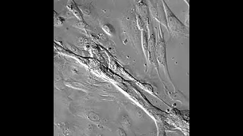Bioptechs FCS2, Human Breast Cells