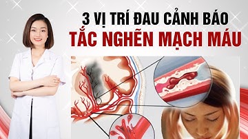Cảnh giác 3 vị trí đau gây tắc nghẽn mạch máu | Dr Thu Hằng