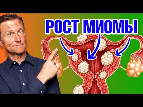Как уменьшить миому