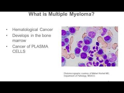 Criteria for Multiple Myeloma