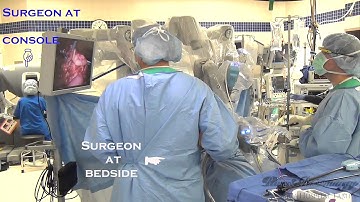 USING ROBOTS TO REMOVE THE ESOPHAGUS