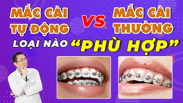 Niềng Răng | Nên Chọn Mắc Cài Tự Động Hay Mắc Cài Thường
