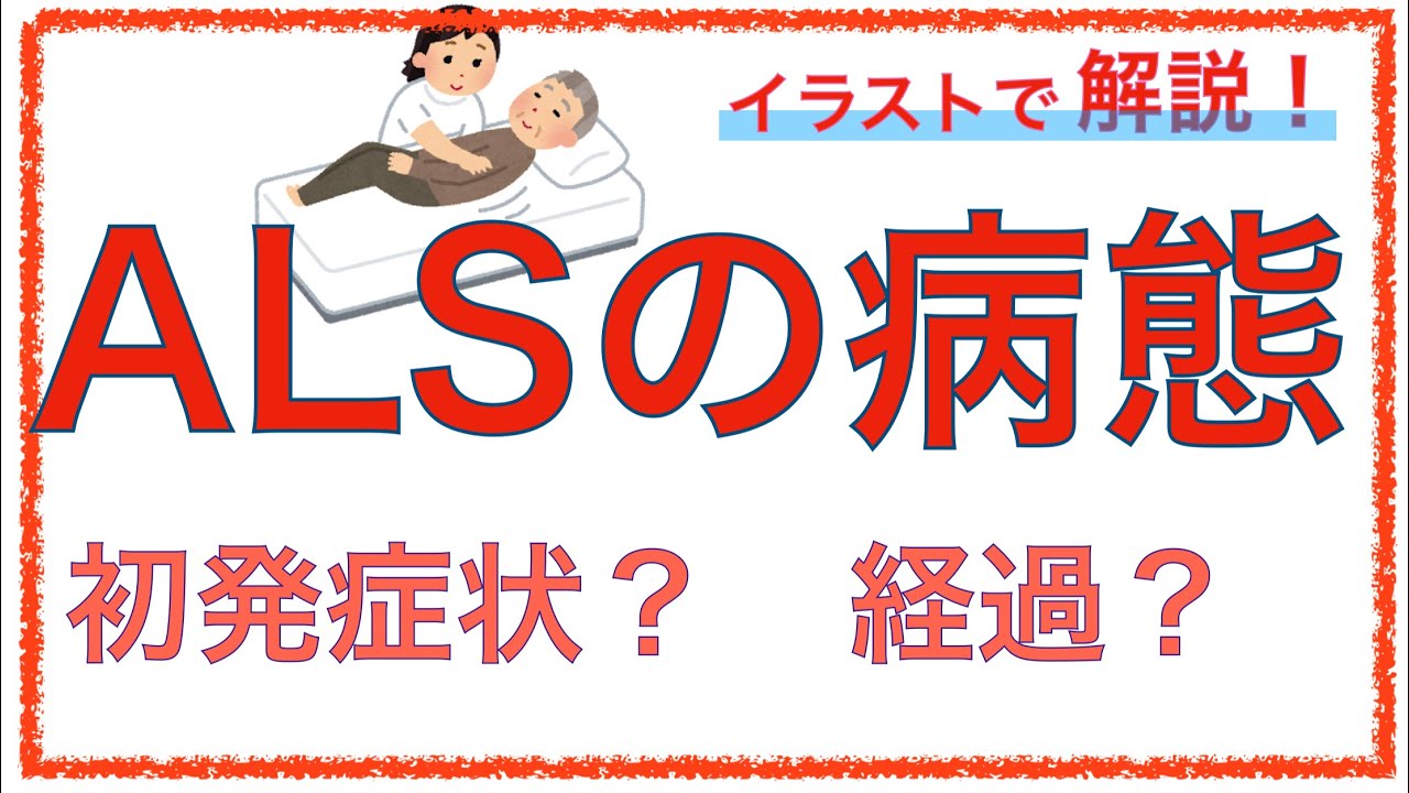 教科書をわかりやすく！「筋萎縮性側索硬化症とは」ALSの初期症状や病態をわかりやすく解説！