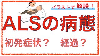 教科書をわかりやすく！「筋萎縮性側索硬化症とは」ALSの初期症状や病態をわかりやすく解説！