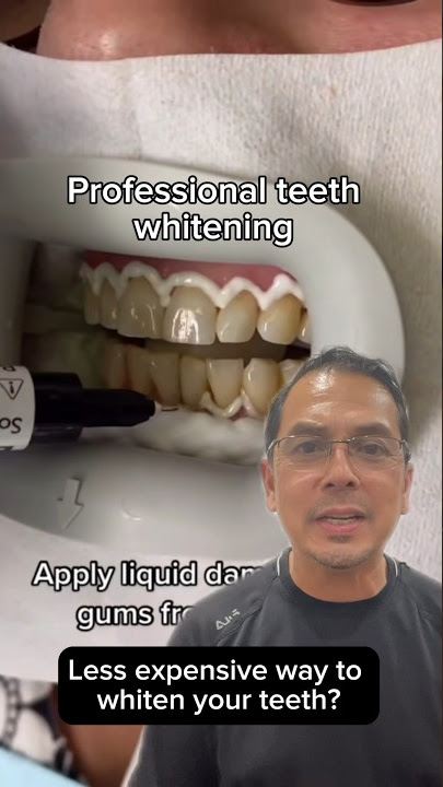 Professional Teeth Whitening vs Hydrogen Peroxide EXPLAINED | In Office to Hands On Dental Training