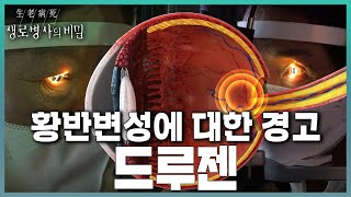 진행 빠른 황반변성 조기 발견의 열쇠, 드루젠 | KBS 240228 방송 by KBS 생로병사의 비밀 31,654 views 1 month ago 35 minutes