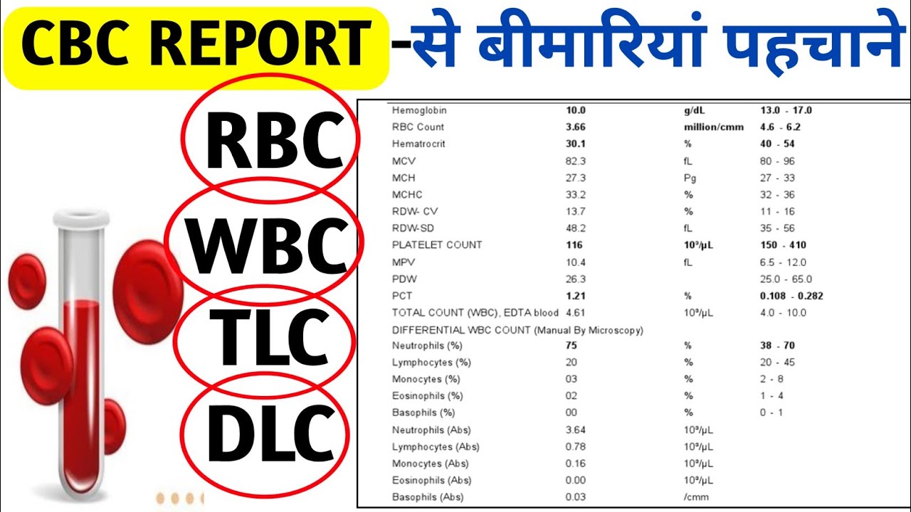 CBC Report से बीमारियां पहचाने | CBC Test | Blood Test | Complete Blood Count | RBC | WBC | 