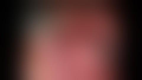 Right Lower Lobe Basilar Segmentectomy - Most Difficult