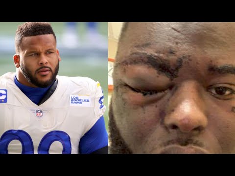 Aaron Donald aasault Hqdefault