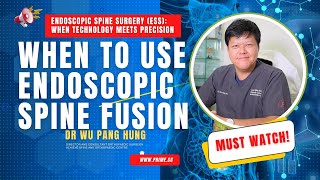 When to Use Endoscopic Spine Fusion | Dr Wu Pang Hung @panghungwu @achievespine #orthopaedicsurgeon
