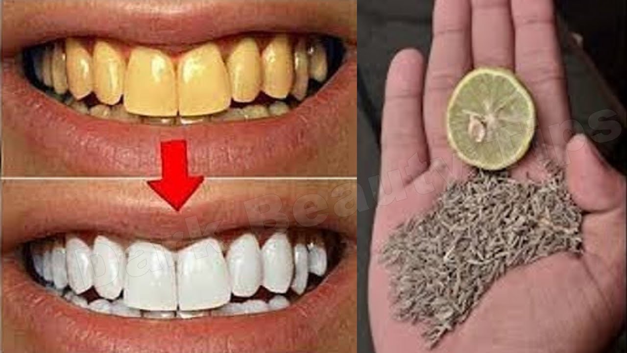 magical-teeth-whitening-remedy-get-whiten-teeth-at-home-in-5-minutes