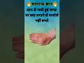 आग से जली हुई जगह पर क्या लगाने से फफोले नहीं बनते? 🔥😲 | GK Facts #shorts