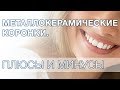 Металлокерамические коронки плюсы и минусы.