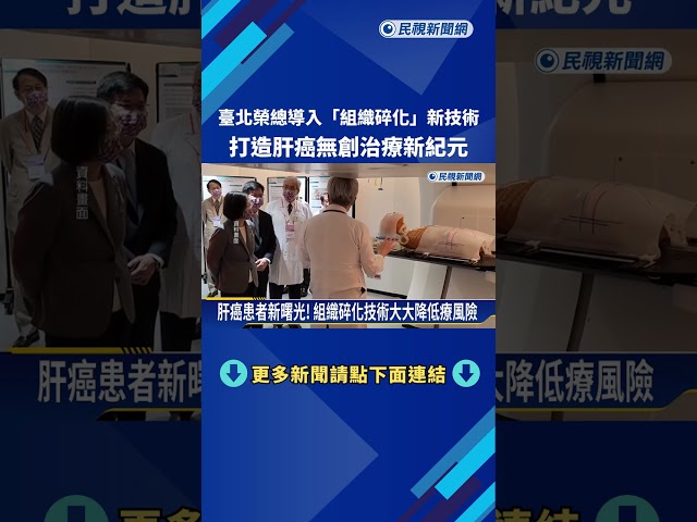 臺北榮總導入"組織碎化"新技術 打造肝癌無創治療新紀元－民視新聞
